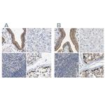 Pericentrin Antibody in Immunohistochemistry (IHC)