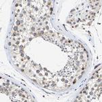 Pericentrin Antibody in Immunohistochemistry (IHC)