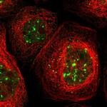 PTPN23 Antibody in Immunocytochemistry (ICC/IF)