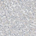 PTPN23 Antibody in Immunohistochemistry (Paraffin) (IHC (P))