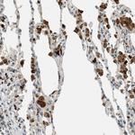 PTPN23 Antibody in Immunohistochemistry (Paraffin) (IHC (P))