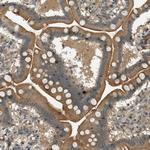 PTPN23 Antibody in Immunohistochemistry (Paraffin) (IHC (P))