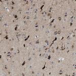 PTDSS1 Antibody in Immunohistochemistry (Paraffin) (IHC (P))