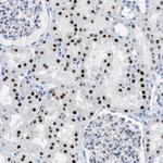 PTDSS1 Antibody in Immunohistochemistry (Paraffin) (IHC (P))