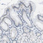 PTDSS1 Antibody in Immunohistochemistry (Paraffin) (IHC (P))