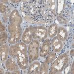 SLC25A20 Antibody in Immunohistochemistry (Paraffin) (IHC (P))