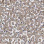 SLC25A20 Antibody in Immunohistochemistry (Paraffin) (IHC (P))