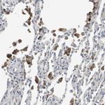 SLC25A20 Antibody in Immunohistochemistry (Paraffin) (IHC (P))