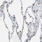 UVRAG Antibody in Immunohistochemistry (Paraffin) (IHC (P))