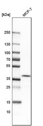 ATP6V0D1 Antibody in Western Blot (WB)