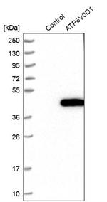 ATP6V0D1 Antibody in Western Blot (WB)