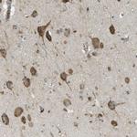 USP30 Antibody in Immunohistochemistry (IHC)