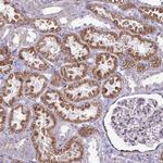 P4HA2 Antibody in Immunohistochemistry (Paraffin) (IHC (P))