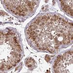 P4HA2 Antibody in Immunohistochemistry (Paraffin) (IHC (P))