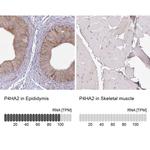 P4HA2 Antibody in Immunohistochemistry (IHC)