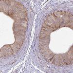 P4HA2 Antibody in Immunohistochemistry (IHC)