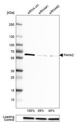 P4HA2 Antibody in Western Blot (WB)