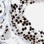 ZNF207 Antibody in Immunohistochemistry (IHC)