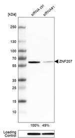 ZNF207 Antibody in Western Blot (WB)