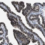 LTA4H Antibody in Immunohistochemistry (Paraffin) (IHC (P))