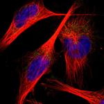 PNKD Antibody in Immunocytochemistry (ICC/IF)