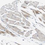 PNKD Antibody in Immunohistochemistry (Paraffin) (IHC (P))