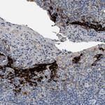 PNKD Antibody in Immunohistochemistry (Paraffin) (IHC (P))