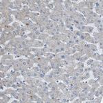 GALNT6 Antibody in Immunohistochemistry (Paraffin) (IHC (P))