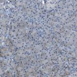 GALNT6 Antibody in Immunohistochemistry (Paraffin) (IHC (P))