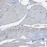 GALNT6 Antibody in Immunohistochemistry (Paraffin) (IHC (P))