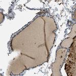 MAN2A2 Antibody in Immunohistochemistry (IHC)