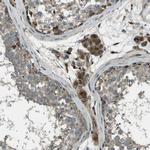 ACPL2 Antibody in Immunohistochemistry (Paraffin) (IHC (P))