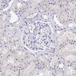 UD2A1 Antibody in Immunohistochemistry (Paraffin) (IHC (P))