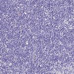 UD2A1 Antibody in Immunohistochemistry (Paraffin) (IHC (P))