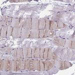 UD2A1 Antibody in Immunohistochemistry (Paraffin) (IHC (P))