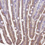 UD2A1 Antibody in Immunohistochemistry (Paraffin) (IHC (P))