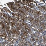 CYP4F11 Antibody in Immunohistochemistry (Paraffin) (IHC (P))