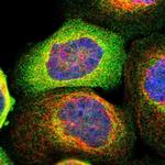 STRN Antibody in Immunocytochemistry (ICC/IF)