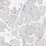 STRN Antibody in Immunohistochemistry (Paraffin) (IHC (P))