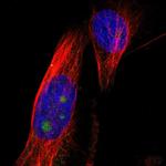 B3GNT5 Antibody in Immunocytochemistry (ICC/IF)