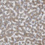 B3GNT5 Antibody in Immunohistochemistry (Paraffin) (IHC (P))