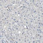 SCN4B Antibody in Immunohistochemistry (Paraffin) (IHC (P))