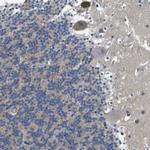 SCN4B Antibody in Immunohistochemistry (IHC)