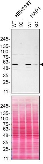 Spastin Antibody in Western Blot (WB)