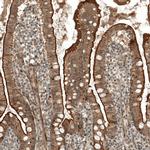 IFNLR1 Antibody in Immunohistochemistry (IHC)