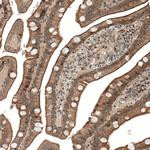 IFNLR1 Antibody in Immunohistochemistry (IHC)