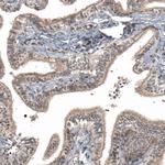 IFNLR1 Antibody in Immunohistochemistry (IHC)