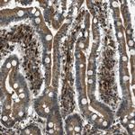 LEMD2 Antibody in Immunohistochemistry (Paraffin) (IHC (P))