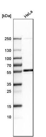 LEMD2 Antibody in Western Blot (WB)