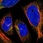 HLCS Antibody in Immunocytochemistry (ICC/IF)